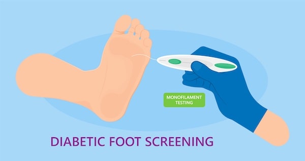 Diabetic foot exam monifilament test